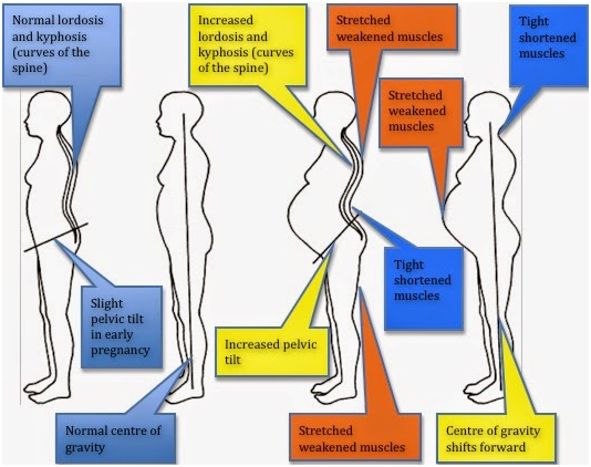 Post-Pregnancy Back Pain Recovery with Inversion Therapy - Being ...